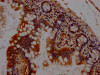 IHC image of CSB-RA176809A0HU diluted at 1:100 and staining in paraffin-embedded human small intestine tissue performed on a Leica BondTM system. After dewaxing and hydration, antigen retrieval was mediated by high pressure in a citrate buffer (pH 6.0). Section was blocked with 10% normal goat serum 30min at RT. Then primary antibody (1% BSA) was incubated at 4°C overnight. The primary is detected by a Goat anti-rabbit IgG polymer labeled by HRP and visualized using 0.05% DAB.