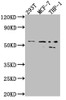 Western Blot<br />
 Positive WB detected in: 293T whole cell lysate, MCF-7 whole cell lysate, THP-1 whole cell lysate<br />
 All lanes: MMP12 antibody at 1:1000<br />
 Secondary<br />
 Goat polyclonal to rabbit IgG at 1/50000 dilution<br />
 Predicted band size: 55 kDa<br />
 Observed band size: 54, 45 kDa<br />