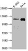 Western Blot<br />
 Positive WB detected in: K562 whole cell lysate, Hela whole cell lysate<br />
 All lanes: NUP98 antibody at 1:1000<br />
 Secondary<br />
 Goat polyclonal to rabbit IgG at 1/50000 dilution<br />
 Predicted band size: 198, 188, 98, 97, 196, 187 kDa<br />
 Observed band size: 100 kDa<br />