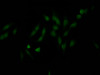 Immunofluorescence staining of Hela Cells with CSB-RA995655A0HU at 1：50, counter-stained with DAPI. The cells were fixed in 4% formaldehyde, permeated by 0.2% TritonX-100, and blocked in 10% normal Goat Serum. The cells were then incubated with the antibody overnight at 4°C. Nuclear DNA was labeled in blue with DAPI. The secondary antibody was FITC-conjugated AffiniPure Goat Anti-Rabbit IgG （H+L）.