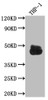 Western Blot<br />
 Positive WB detected in: THP-1 whole cell lysate<br />
 All lanes: CD32 antibody at 1:1000<br />
 Secondary<br />
 Goat polyclonal to rabbit IgG at 1/50000 dilution<br />
 Predicted band size: 35, 36 kDa<br />
 Observed band size: 45 kDa<br />