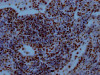 IHC image of CSB-RA915915A0HU diluted at 1:100 and staining in paraffin-embedded human lung tissue performed on a Leica BondTM system. After dewaxing and hydration, antigen retrieval was mediated by high pressure in a citrate buffer (pH 6.0). Section was blocked with 10% normal goat serum 30min at RT. Then primary antibody (1% BSA) was incubated at 4°C overnight. The primary is detected by a Goat anti-rabbit IgG polymer labeled by HRP and visualized using 0.05% DAB.