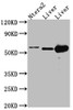 Western Blot<br />
 Positive WB detected in: Ntera-2 whole cell lysate, Mouse Liver whole cell lysate, Rat Liver cell lysate<br />
 All lanes: ALDH2 antibody at 1:1000<br />
 Secondary<br />
 Goat polyclonal to rabbit IgG at 1/50000 dilution<br />
 Predicted band size: 57, 51 kDa<br />
 Observed band size: 57 kDa<br />