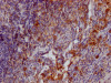 IHC image of CSB-RA567010A0HU diluted at 1:100 and staining in paraffin-embedded human tonsil tissue performed on a Leica BondTM system. After dewaxing and hydration, antigen retrieval was mediated by high pressure in a citrate buffer (pH 6.0). Section was blocked with 10% normal goat serum 30min at RT. Then primary antibody (1% BSA) was incubated at 4°C overnight. The primary is detected by a Goat anti-rabbit IgG polymer labeled by HRP and visualized using 0.05% DAB.