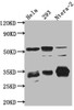 Western Blot<br />
 Positive WB detected in: Hela whole cell lysate, HEK293 whole cell lysate, Ntera-2 cell lysate<br />
 All lanes: CASP3 antibody at 1:1000<br />
 Secondary<br />
 Goat polyclonal to rabbit IgG at 1/50000 dilution<br />
 Predicted band size: 32 kDa<br />
 Observed band size: 32, 55, 130 kDa<br />