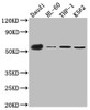 Western Blot<br />
 Positive WB detected in: Daudi whole cell lysate, HL-60 whole cell lysate, THP-1 cell lysate, K562 cell lysate<br />
 All lanes: CD27 antibody at 1:1000<br />
 Secondary<br />
 Goat polyclonal to rabbit IgG at 1/50000 dilution<br />
 Predicted band size: 30 kDa<br />
 Observed band size: 55 kDa<br />