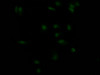 Immunofluorescence staining of MCF7 Cells with CSB-RA155156A0HU at 1：50, counter-stained with DAPI. The cells were fixed in 4% formaldehyde, permeated by 0.2% TritonX-100, and blocked in 10% normal Goat Serum. The cells were then incubated with the antibody overnight at 4°C. Nuclear DNA was labeled in blue with DAPI. The secondary antibody was FITC-conjugated AffiniPure Goat Anti-Rabbit IgG （H+L）.