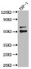 Western Blot<br />
 Positive WB detected in: A549 whole cell lysate, U-251 whole cell lysate, Hela whole cell lysate<br />
 All lanes: FLI1 antibody at 1:1000<br />
 Secondary<br />
 Goat polyclonal to rabbit IgG at 1/50000 dilution<br />
 Predicted band size: 51, 44, 48, 30 kDa<br />
 Observed band size: 51 kDa<br />