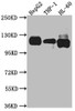 Western Blot<br />
 Positive WB detected in: HepG2 whole cell lysate, THP-1 whole cell lysate, HL-60 whole cell lysate<br />
 All lanes: Notch1 antibody at 1:1000<br />
 Secondary<br />
 Goat polyclonal to rabbit IgG at 1/50000 dilution<br />
 Predicted band size: 273 kDa<br />
 Observed band size: 120 kDa<br />