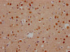 IHC image of CSB-RA599445A0HU diluted at 1:100 and staining in paraffin-embedded human brain tissue performed on a Leica BondTM system. After dewaxing and hydration, antigen retrieval was mediated by high pressure in a citrate buffer (pH 6.0). Section was blocked with 10% normal goat serum 30min at RT. Then primary antibody (1% BSA) was incubated at 4°C overnight. The primary is detected by a Goat anti-rabbit IgG polymer labeled by HRP and visualized using 0.05% DAB.