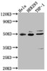 Western Blot<br />
 Positive WB detected in: Hela whole cell lysate, HEK293 whole cell lysate, THP-1 whole cell lysate<br />
 All lanes: MAPKAPK2 antibody at 1:1000<br />
 Secondary<br />
 Goat polyclonal to rabbit IgG at 1/50000 dilution<br />
 Predicted band size: 46, 43 kDa<br />
 Observed band size: 49 kDa<br />
