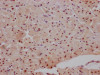 IHC image of CSB-RA990134A0HU diluted at 1:100 and staining in paraffin-embedded human heart tissue performed on a Leica BondTM system. After dewaxing and hydration, antigen retrieval was mediated by high pressure in a citrate buffer (pH 6.0). Section was blocked with 10% normal goat serum 30min at RT. Then primary antibody (1% BSA) was incubated at 4°C overnight. The primary is detected by a Goat anti-rabbit IgG polymer labeled by HRP and visualized using 0.05% DAB.