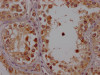 IHC image of CSB-RA554990A0HU diluted at 1:100 and staining in paraffin-embedded human testis tissue performed on a Leica BondTM system. After dewaxing and hydration, antigen retrieval was mediated by high pressure in a citrate buffer (pH 6.0). Section was blocked with 10% normal goat serum 30min at RT. Then primary antibody (1% BSA) was incubated at 4°C overnight. The primary is detected by a Goat anti-rabbit IgG polymer labeled by HRP and visualized using 0.05% DAB.