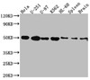 Western Blot<br />
 Positive WB detected in: Hela whole cell lysate, U-251 whole cell lysate, U-87 whole cell lysate, K562 whole cell lysate, HL-60 whole cell lysate, Rat Spleen whole cell lysate, Rat Brain whole cell lysate<br />
 All lanes: Dopamine Receptor D3 antibody at 1:1000<br />
 Secondary<br />
 Goat polyclonal to rabbit IgG at 1/50000 dilution<br />
 Predicted band size: 45, 41 kDa<br />
 Observed band size: 50 kDa<br />