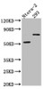 Western Blot<br />
 Positive WB detected in: Ntera-2 whole cell lysate, HEK293 whole cell lysate<br />
 All lanes: GABA A Receptor alpha 5 antibody at 1:1000<br />
 Secondary<br />
 Goat polyclonal to rabbit IgG at 1/50000 dilution<br />
 Predicted band size: 53 kDa<br />
 Observed band size: 70 kDa<br />