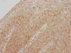 IHC image of CSB-RA961467A0HU diluted at 1:100 and staining in paraffin-embedded human tonsil tissue performed on a Leica BondTM system. After dewaxing and hydration, antigen retrieval was mediated by high pressure in a citrate buffer (pH 6.0). Section was blocked with 10% normal goat serum 30min at RT. Then primary antibody (1% BSA) was incubated at 4°C overnight. The primary is detected by a Goat anti-rabbit IgG polymer labeled by HRP and visualized using 0.05% DAB.