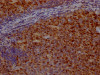 IHC image of CSB-RA209144A0HU diluted at 1:100 and staining in paraffin-embedded human tonsil tissue performed on a Leica BondTM system. After dewaxing and hydration, antigen retrieval was mediated by high pressure in a citrate buffer (pH 6.0). Section was blocked with 10% normal goat serum 30min at RT. Then primary antibody (1% BSA) was incubated at 4°C overnight. The primary is detected by a Goat anti-rabbit IgG polymer labeled by HRP and visualized using 0.05% DAB.