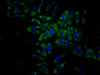 Immunofluorescence staining of Hela Cells with CSB-RA190088A0HU at 1：50, counter-stained with DAPI. The cells were fixed in 4% formaldehyde, permeated by 0.2% TritonX-100, and blocked in 10% normal Goat Serum. The cells were then incubated with the antibody overnight at 4°C. Nuclear DNA was labeled in blue with DAPI. The secondary antibody was FITC-conjugated AffiniPure Goat Anti-Rabbit IgG （H+L）.