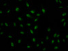 Immunofluorescence staining of Hela Cells with CSB-RA289890A0HU at 1：50, counter-stained with DAPI. The cells were fixed in 4% formaldehyde, permeated by 0.2% TritonX-100, and blocked in 10% normal Goat Serum. The cells were then incubated with the antibody overnight at 4°C. Nuclear DNA was labeled in blue with DAPI. The secondary antibody was FITC-conjugated AffiniPure Goat Anti-Rabbit IgG （H+L）.