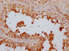 IHC image of CSB-RA560252A0HU diluted at 1:100 and staining in paraffin-embedded human testis tissue performed on a Leica BondTM system. After dewaxing and hydration, antigen retrieval was mediated by high pressure in a citrate buffer (pH 6.0). Section was blocked with 10% normal goat serum 30min at RT. Then primary antibody (1% BSA) was incubated at 4°C overnight. The primary is detected by a Goat anti-rabbit IgG polymer labeled by HRP and visualized using 0.05% DAB.