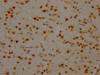 IHC image of CSB-RA984434A0HU diluted at 1:100 and staining in paraffin-embedded human brain tissue performed on a Leica BondTM system. After dewaxing and hydration, antigen retrieval was mediated by high pressure in a citrate buffer (pH 6.0). Section was blocked with 10% normal goat serum 30min at RT. Then primary antibody (1% BSA) was incubated at 4°C overnight. The primary is detected by a Goat anti-rabbit IgG polymer labeled by HRP and visualized using 0.05% DAB.