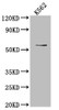 Western Blot<br />
 Positive WB detected in: K562 whole cell lysate<br />
 All lanes: UAP1 antibody at 1:1000<br />
 Secondary<br />
 Goat polyclonal to rabbit IgG at 1/50000 dilution<br />
 Predicted band size: 59, 58, 59 kDa<br />
 Observed band size: 59 kDa<br />