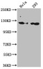 Western Blot<br />
 Positive WB detected in: Hela whole cell lysate, 293 whole cell lysate<br />
 All lanes: RNF20 antibody at 1:1000<br />
 Secondary<br />
 Goat polyclonal to rabbit IgG at 1/50000 dilution<br />
 Predicted band size: 114 kDa<br />
 Observed band size: 114 kDa<br />