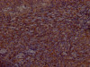 IHC image of CSB-RA553167A0HU diluted at 1:100 and staining in paraffin-embedded human tonsil tissue performed on a Leica BondTM system. After dewaxing and hydration, antigen retrieval was mediated by high pressure in a citrate buffer (pH 6.0). Section was blocked with 10% normal goat serum 30min at RT. Then primary antibody (1% BSA) was incubated at 4°C overnight. The primary is detected by a Goat anti-rabbit IgG polymer labeled by HRP and visualized using 0.05% DAB.