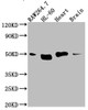 Western Blot<br />
 Positive WB detected in: RAW264.7 whole cell lysate, HL-60 whole cell lysate, Mouse Herat whole cell lysate, Mouse Brain whole cell lysate<br />
 All lanes: Tin2 antibody at 1:1000<br />
 Secondary<br />
 Goat polyclonal to rabbit IgG at 1/50000 dilution<br />
 Predicted band size: 51, 40, 16 kDa<br />
 Observed band size: 51 kDa<br />