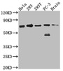 Western Blot<br />
 Positive WB detected in: Hela whole cell lysate, 293 whole cell lysate, 293T whole cell lysate, PC-3 whole cell lysate, Mouse Brain whole cell lysate<br />
 All lanes: LTA4H antibody at 1:1000<br />
 Secondary<br />
 Goat polyclonal to rabbit IgG at 1/50000 dilution<br />
 Predicted band size: 70, 60, 58, 67 kDa<br />
 Observed band size: 70 kDa<br />