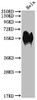 Western Blot<br />
 Positive WB detected in: Hela whole cell lysate<br />
 All lanes: CD46 antibody at 1:1000<br />
 Secondary<br />
 Goat polyclonal to rabbit IgG at 1/50000 dilution<br />
 Predicted band size: 44, 45, 43, 41, 42, 40, 37 kDa<br />
 Observed band size: 56 kDa<br />