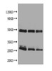 Western blot<br />All lanes : Rat IgG antibody at 2ug/ml<br />
 Lane 1 : Rat IgG protein 70ng<br />
 Lane 2 : Rat IgG protein 50ng<br />
 Lane 3 : Rat IgG protein 30ng<br />
 Secondary<br />
 Goat polyclonal to Rabbit IgG at 1/50000 dilution