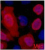 IF analysis of 293 cells transfected with a Myc-tag protein,1:2000 dilution (blue DAPI, red anti-Myc)