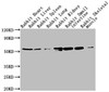 Western Blot<br />
 Positive WB detected in: Rabbit heatrt tissue, Rabbit liver tissue, Rabbit spleen tissue, Rabbit lung tissue, Rabbit kidney tissue, Rabbit small intestine tissue, Rabbit skeletal muscle tissue<br />
 All lanes: TUBA1A antibody at 1:5000<br />
 Secondary<br />
 Goat polyclonal to Mouse IgG at 1/10000 dilution<br />
 Predicted band size: 52 kDa<br />
 Observed band size: 52 kDa<br />