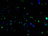 Immunofluorescence staining of Hela cells with（CSB-MA000071M1m）at 1:50, counter-stained with DAPI. The cells were fixed in 4% formaldehyde, permeabilized using 0.2% Triton X-100 and blocked in 10% normal Goat Serum. The cells were then incubated with the antibody overnight at 4°C. Nuclear DNA was labeled in blue with DAPI. The secondary antibody was FITC-conjugated AffiniPure Goat Anti-Mouse IgG (H+L).