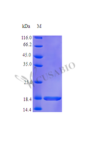 Recombinant Human Lymphotoxin-alpha protein (LTA) (Active) | CSB-AP002171HU