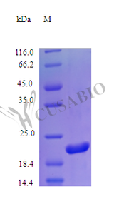 Recombinant Human Somatotropin protein (GH1) (Active) | CSB-AP000011HU