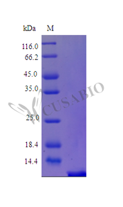 Recombinant Human Parathyroid hormone protein (PTH) (Active) | CSB-AP000021HU