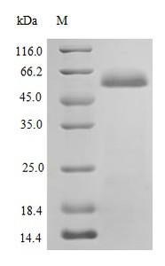 Recombinant Human Protein disulfide-isomerase protein (P4HB) (Active) | CSB-AP000091HU