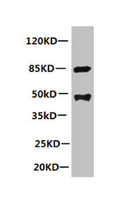 All lanes: Mouse anti-human Platelet-activating factor acetylhydrolase monoclonal Antibody at 1ug/ml<br />
 Lane 1:mouse spleen tissue<br />
 Secondary:HRP labeled Goat polyclonal to Mouse IgG at 1/3000 dilution<br />
 Predicted band size : 48kd<br />
 Observed band size : 44kd<br />
 Additional bands at: 85kd<br />