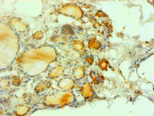 Immunohistochemical of paraffin-embedded human thyroid tissues using CSB-MA1213441A0m at dilution of 1:200