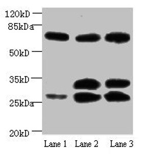 Western blot<br />
 All lanes: Amyloid beta A4 antibody at 1µg/ml<br />
 Lane 1: Mouse heart tissue<br />
 Lane 2: Mouse kidney tissue<br />
 Lane 3: Mouse lung tissue<br />
 Secondary<br />
 Goat polyclonal to Mouse IgG at 1/15000 dilution<br />
 Predicted band size: 30, 35, 72, 80 kDa<br />
 Observed band size: 30, 35, 72 kDa<br />