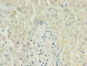 Immunohistochemistry of paraffin-embedded human liver using CSB-MA027411E0m in 30ug/ml dilute concentrations.