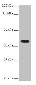 Western blot<br />
 All lanes: Interleukin-12 subunit beta antibody at 14µg/ml + K562 whole cell lysate<br />
 Secondary<br />
 Goat polyclonal to rabbit IgG at 1/10000 dilution<br />
 Predicted band size: 37 kDa<br />
 Observed band size: 37 kDa<br />