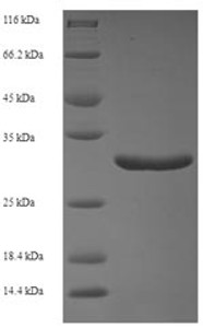 (Tris-Glycine gel) Discontinuous SDS-PAGE (reduced) with 5% enrichment gel and 15% separation gel.