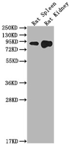 Western Blot<br />
 Positive WB detected in: Rat Spleen tissue, Rat Kidney tissue<br />
 All lanes: Ace2 antibody at 1:2000<br />
 Secondary<br />
 Goat polyclonal to rabbit IgG at 1/50000 dilution<br />
 Predicted band size: 93 kDa<br />
 Observed band size: 93 kDa<br />