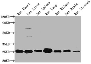 Western Blot<br />
 Positive WB detected in: Rat Heart tissue, Rat Liver tissue, Rat Spleen tissue, Rat Lung tissue, Rat Kidney tissue, Rat Brain tissue, Rat Stomach tissue<br />
 All lanes: Apoa1 antibody at 1:2000<br />
 Secondary<br />
 Goat polyclonal to rabbit IgG at 1/50000 dilution<br />
 Predicted band size: 31 kDa<br />
 Observed band size: 31 kDa<br />