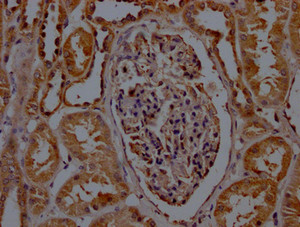IHC image of CSB-PA020907LA01HU diluted at 1:200 and staining in paraffin-embedded human kidney tissue performed on a Leica BondTM system. After dewaxing and hydration, antigen retrieval was mediated by high pressure in a citrate buffer (pH 6.0) . Section was blocked with 10% normal goat serum 30min at RT. Then primary antibody (1% BSA) was incubated at 4°C overnight. The primary is detected by a Goat anti-rabbit polymer IgG labeled by HRP and visualized using 0.05% DAB.