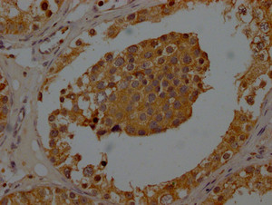 IHC image of CSB-PA025898LA01HU diluted at 1:200 and staining in paraffin-embedded human testis tissue performed on a Leica BondTM system. After dewaxing and hydration, antigen retrieval was mediated by high pressure in a citrate buffer (pH 6.0) . Section was blocked with 10% normal goat serum 30min at RT. Then primary antibody (1% BSA) was incubated at 4°C overnight. The primary is detected by a Goat anti-rabbit polymer IgG labeled by HRP and visualized using 0.05% DAB.