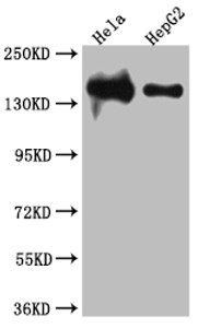 Western Blot<br />
 Positive WB detected in: Hela whole cell lysate, HepG2 whole cell lysate<br />
 All lanes: DNA Ligase I antibody at 1:1000<br />
 Secondary<br />
 Goat polyclonal to rabbit IgG at 1/50000 dilution<br />
 Predicted band size: 102, 89, 99 kDa<br />
 Observed band size: 140 kDa<br />